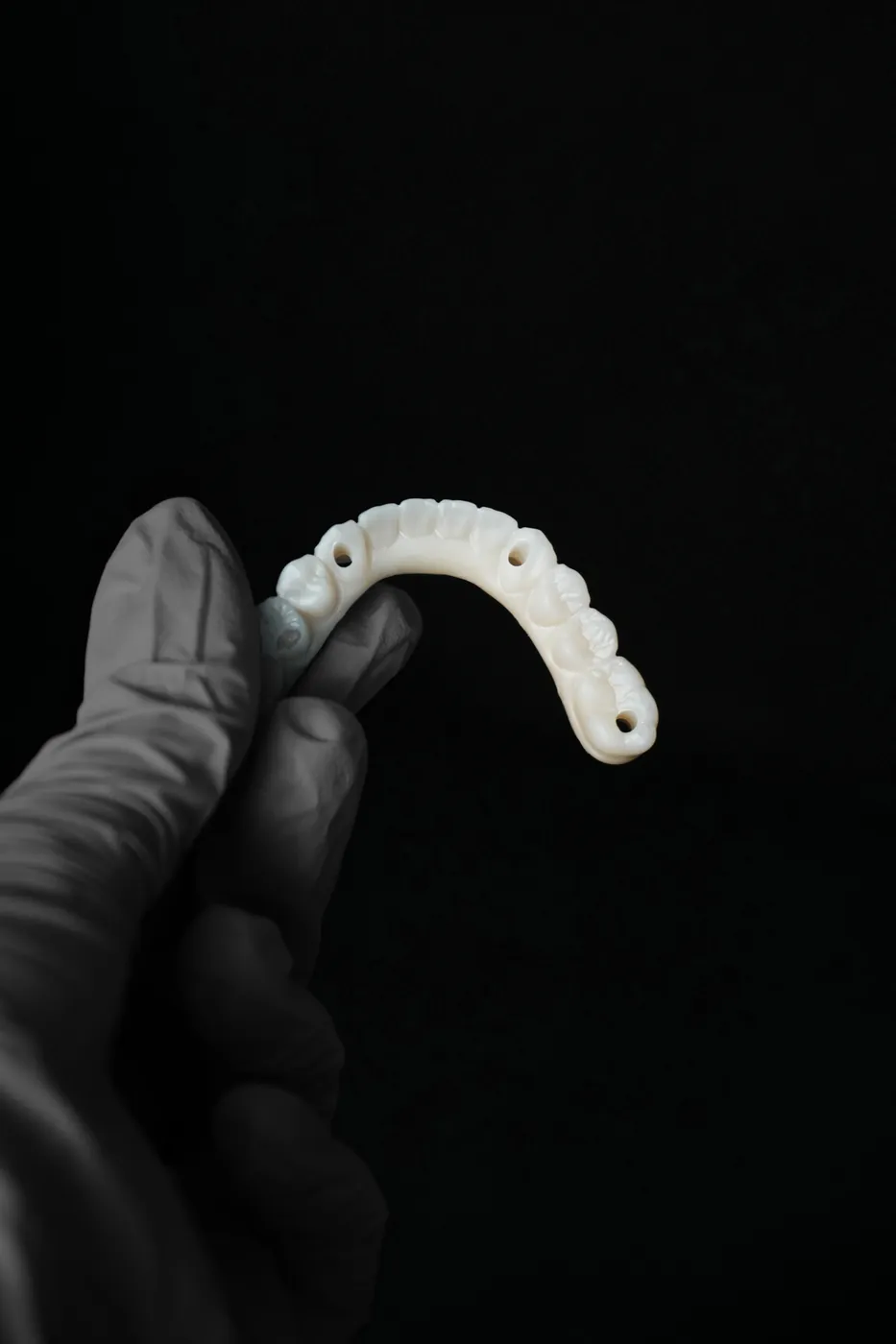 Pełny łuk na implantach