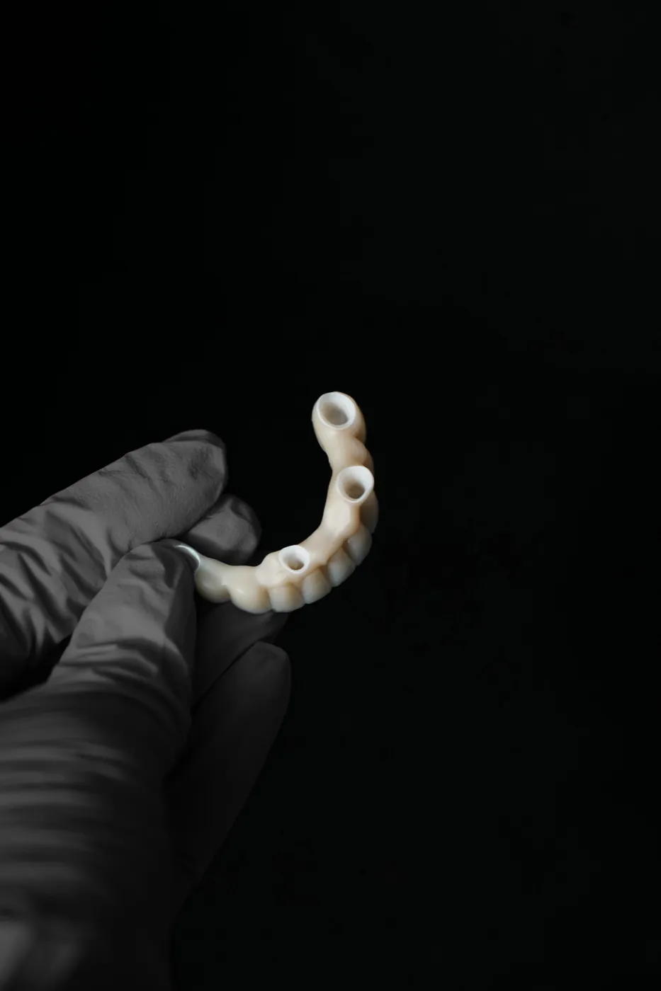 Pełny łuk na implantach