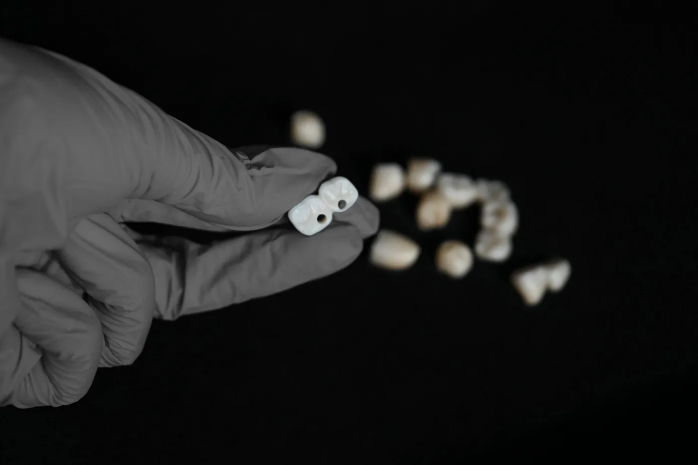Korony na implantach